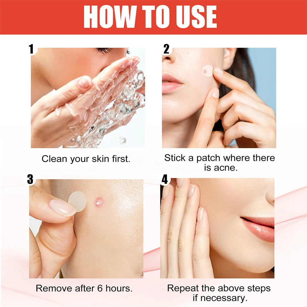 Pimple Patches (durchsichtig)