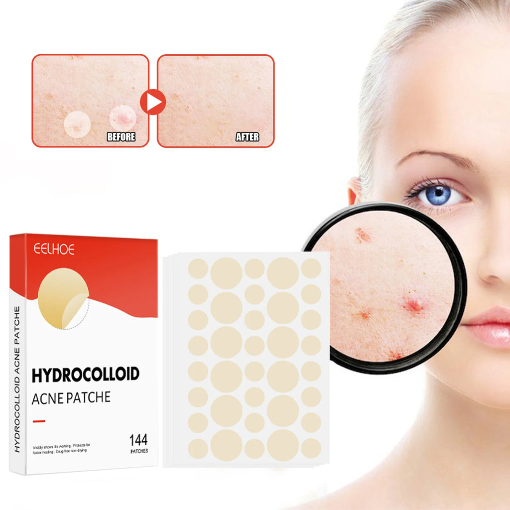 Pimple Patches (durchsichtig)