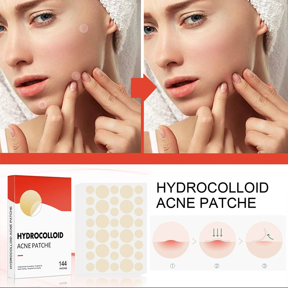 Pimple Patches (durchsichtig)