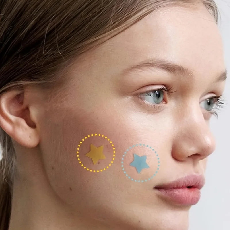 StarGlow Pimple Patches
